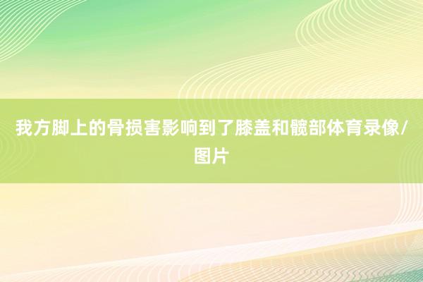 我方脚上的骨损害影响到了膝盖和髋部体育录像/图片